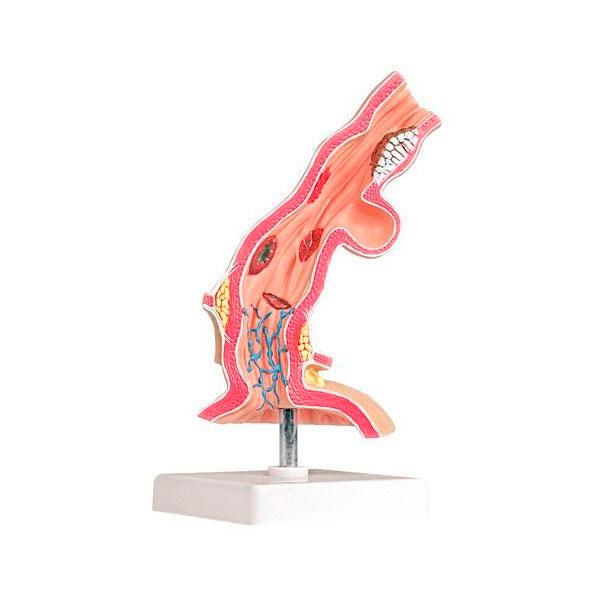 Pathological Model Of Esophagus product photo