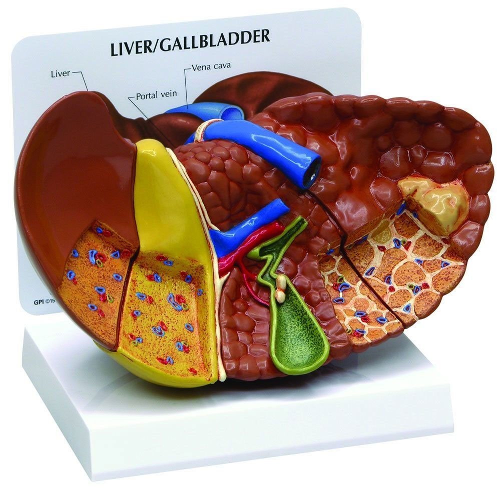 Pathological Model Of The Human Liver product photo
