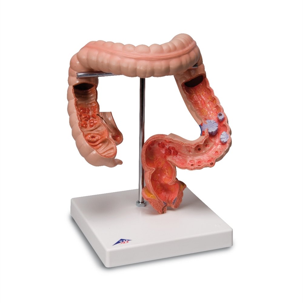 Gastric Diseases Model product photo
