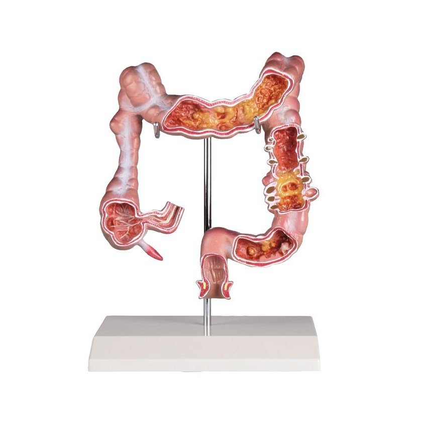 Colon Diseases Model product photo